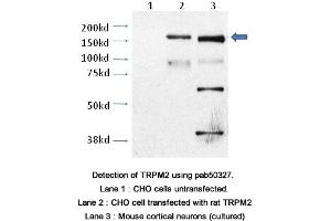 Image no. 2 for anti-Transient Receptor Potential Cation Channel, Subfamily M, Member 2 (TRPM2) (AA 1430-1508), (C-Term) antibody (ABIN363636)