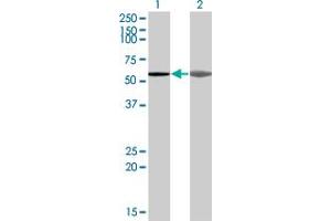 Image no. 1 for anti-A Kinase (PRKA) Anchor Protein 5 (AKAP5) (AA 334-427) antibody (ABIN522977)