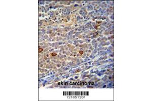 Image no. 2 for anti-Chromosome 9 Open Reading Frame 156 (C9orf156) (AA 365-391), (C-Term) antibody (ABIN390925)