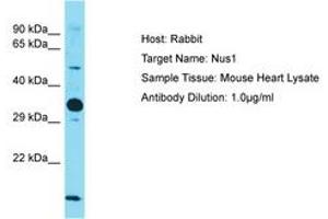 Image no. 1 for anti-Nogo B Receptor (NUS1) (AA 151-200) antibody (ABIN6750531)