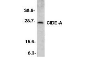 Image no. 2 for anti-Cell Death-Inducing DFFA-Like Effector A (CIDEA) (C-Term) antibody (ABIN499627)