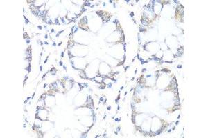 Immunohistochemistry of paraffin-embedded Human colon using SDHB Polyclonal Antibody at dilution of 1:100 (40x lens).