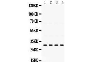 Image no. 2 for anti-Insulin-Like Growth Factor Binding Protein 3 (IGFBP3) (AA 214-252), (C-Term) antibody (ABIN3043859)