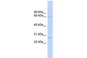 Image no. 1 for anti-Mitochondrial Ribosomal Protein L13 (MRPL13) (AA 107-156) antibody (ABIN6743790)