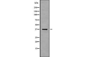 Image no. 1 for anti-Endonuclease 8-like 2 (NEIL2) (Internal Region) antibody (ABIN6263588)