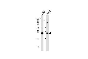 Image no. 1 for anti-Interleukin 1 Receptor Antagonist (IL1RN) (AA 147-177), (C-Term) antibody (ABIN1882098)