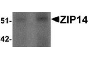 Western blot analysis of ZIP14 in human spleen tissue lysate with ZIP14 antibody at (left) 1 and (right) 2 μg/ml.