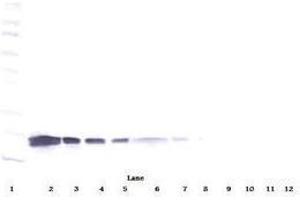 Image no. 3 for anti-Vascular Endothelial Growth Factor A (VEGFA) antibody (ABIN465273)
