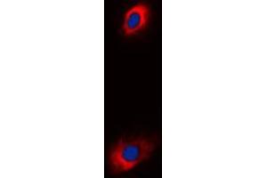 Image no. 1 for anti-Solute Carrier Family 25 (Mitochondrial Carrier, Adenine Nucleotide Translocator), Member 31 (SLC25A31) (Center) antibody (ABIN2705476)