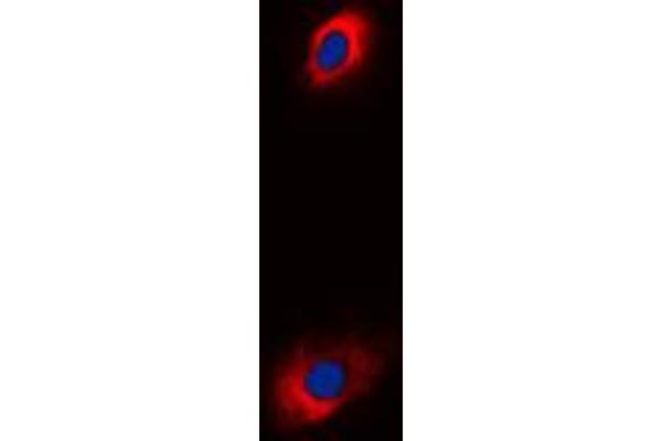 anti-Solute Carrier Family 25 (Mitochondrial Carrier, Adenine Nucleotide Translocator), Member 31 (SLC25A31) (Center) antibody