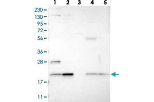 Image no. 2 for anti-Transmembrane Protein 65 (TMEM65) antibody (ABIN5589719)