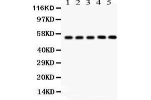 Image no. 4 for anti-Y Box Binding Protein 1 (YBX1) (AA 293-320), (C-Term) antibody (ABIN3043966)