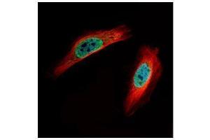 Image no. 1 for anti-Chloride Intracellular Channel 4 (CLIC4) (Center) antibody (ABIN2855985)