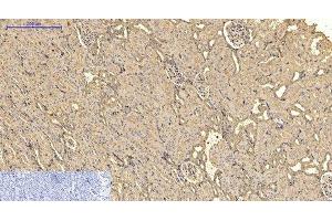 Immunohistochemistry of paraffin-embedded Rat kidney tissue using ACTA2 Monoclonal Antibody at dilution of 1:200.