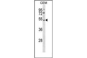 Image no. 1 for anti-Purinergic Receptor P2Y, G-Protein Coupled, 2 (P2RY2) (AA 323-352), (C-Term) antibody (ABIN953967)