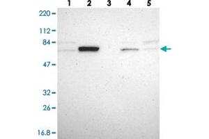 Image no. 3 for anti-Grainyhead-Like 1 (GRHL1) antibody (ABIN5579314)