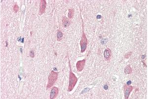Image no. 1 for anti-Hermansky-Pudlak Syndrome 6 (HPS6) (Internal Region) antibody (ABIN185340)