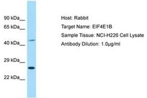 EIF4E1B 抗体  (AA 114-163)