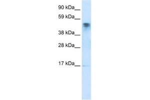 anti-FLJ13798 (FLJ13798) antibody