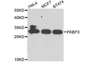 Image no. 1 for anti-FK506 Binding Protein 3, 25kDa (FKBP3) antibody (ABIN6140656)