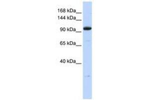 Image no. 1 for anti-Zinc Finger Protein 112 (ZFP112) (N-Term) antibody (ABIN6740571)