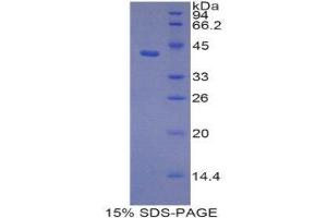 Image no. 1 for Profilin 3 (PFN3) (AA 1-132) protein (His tag,GST tag) (ABIN1878052)