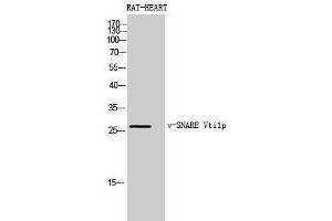 Image no. 1 for anti-Vesicle Transport through Interaction with T-SNAREs Homolog 1B (VTI1B) (Internal Region) antibody (ABIN3180944)