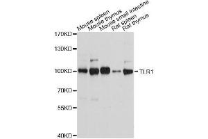 Image no. 3 for anti-Toll-Like Receptor 1 (TLR1) antibody (ABIN3023655)