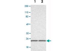 Image no. 3 for anti-RAB13, Member RAS Oncogene Family (RAB13) antibody (ABIN5586660)