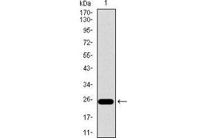 Integrin beta 4 antibody  (AA 1619-1822)