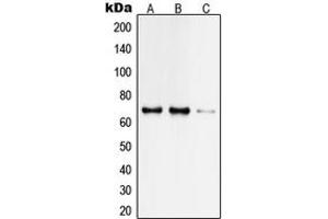 Image no. 2 for anti-TAF6-Like RNA Polymerase II, P300/CBP-Associated Factor (PCAF)-Associated Factor, 65kDa (TAF6L) (N-Term) antibody (ABIN2707756)