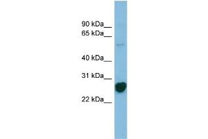 anti-Ribosomal Protein L10a (RPL10A) (N-Term) antibody
