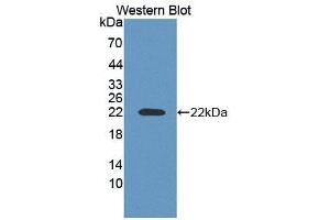 Image no. 1 for anti-Adrenocortical Dysplasia Homolog (ACD) (AA 147-342) antibody (ABIN5013094)