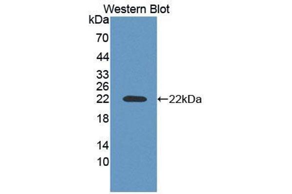 ACD antibody  (AA 147-342)