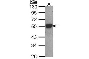 Image no. 2 for anti-Cytochrome P450, Family 2, Subfamily D, Polypeptide 6 (CYP2D6) (AA 268-457) antibody (ABIN467616)