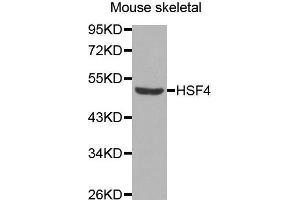 Image no. 1 for anti-Heat Shock Transcription Factor 4 (HSF4) antibody (ABIN1680357)