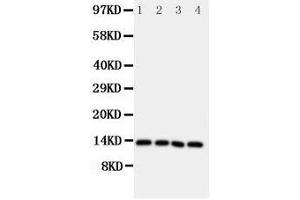 Image no. 2 for anti-Somatostatin (SST) (AA 89-107), (C-Term) antibody (ABIN3044066)