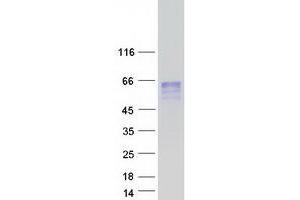 Chordin-Like 2 (CHRDL2) protein (Myc-DYKDDDDK Tag)