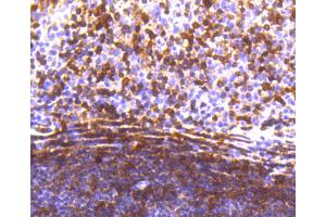 Immunohistochemistry (Paraffin-embedded Sections) (IHC (p)) image for anti-Signal Transducer and Activator of Transcription 5A (STAT5A) antibody (ABIN5557532)