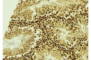 Image no. 1 for anti-Cell Cycle Checkpoint Protein RAD1 (RAD1) (Internal Region) antibody (ABIN6264605)