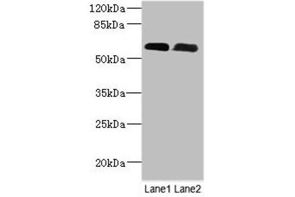 PNPLA1 antibody  (AA 101-300)