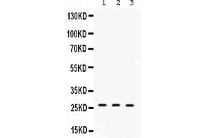Image no. 3 for anti-Dimethylarginine Dimethylaminohydrolase 2 (DDAH2) (AA 190-224), (C-Term) antibody (ABIN4886561)
