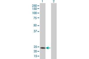 Image no. 2 for anti-RERG/RAS-Like (RERGL) (AA 1-205) antibody (ABIN529051)