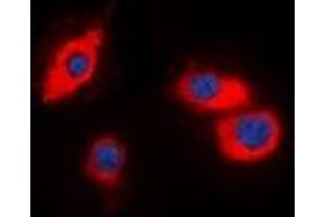 Image no. 1 for anti-Cell Death-Inducing DFFA-Like Effector B (CIDEB) antibody (ABIN3222861)