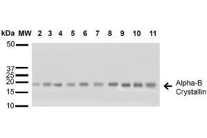 Image no. 2 for anti-Crystallin, alpha B (CRYAB) antibody (Atto 488) (ABIN2486800)