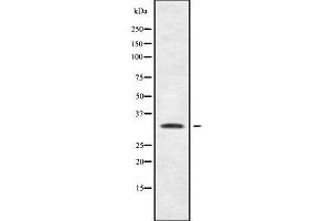 Image no. 1 for anti-Short Stature Homeobox (SHOX) (N-Term) antibody (ABIN6265072)