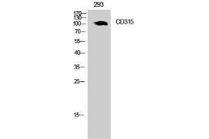 Image no. 1 for anti-Prostaglandin F2 Receptor Negative Regulator (PTGFRN) (Internal Region) antibody (ABIN3181475)