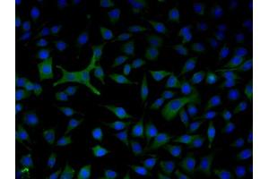 Image no. 2 for anti-Complement Factor B (CFB) (AA 301-400) antibody (ABIN1386781)