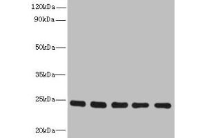 RAB6B antibody  (AA 2-208)