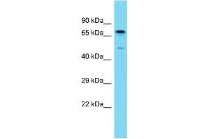 Image no. 1 for anti-BPI Fold Containing Family B, Member 3 (BPIFB3) (N-Term) antibody (ABIN2791409)